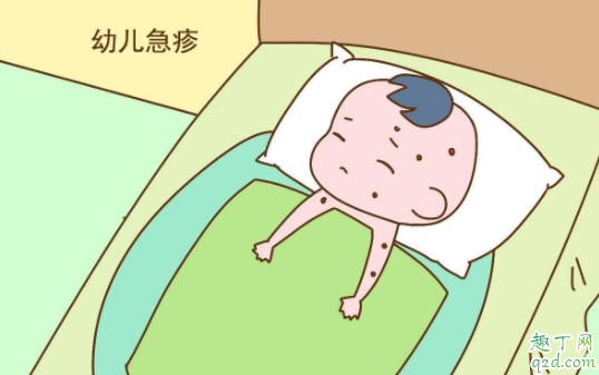 宝宝有幼儿急疹怎么办 为什么会得幼儿急疹