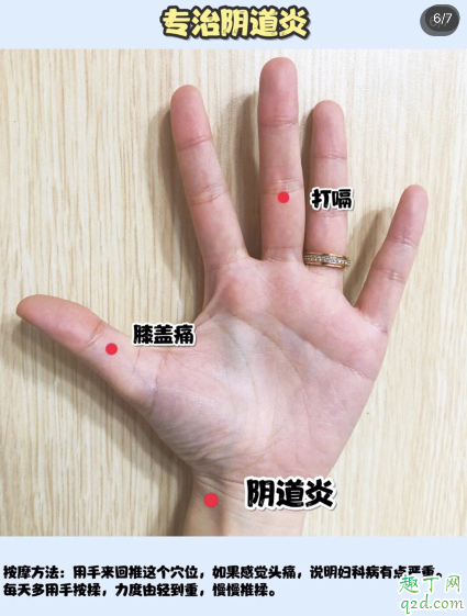 大姨妈和白带判断你有没有妇科病 自测妇科炎症小妙招