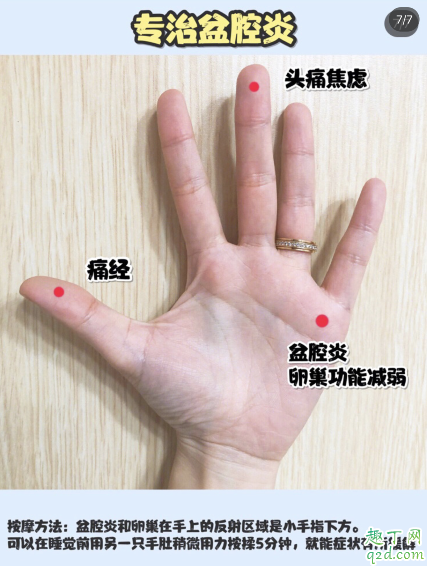 大姨妈和白带判断你有没有妇科病 自测妇科炎症小妙招