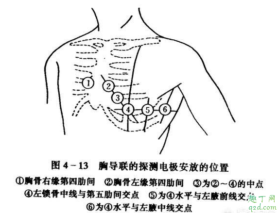 心电图查冠心病准确吗 心衰做心电图可以看得出来吗