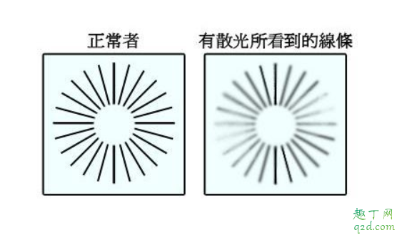 散光有假性和真性吗 眼睛散光应该怎么治疗