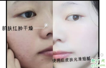 丹润诗火山灰清肤焕颜面膜敏感肌可以用吗 丹润诗火山灰清肤焕颜面膜使用测评