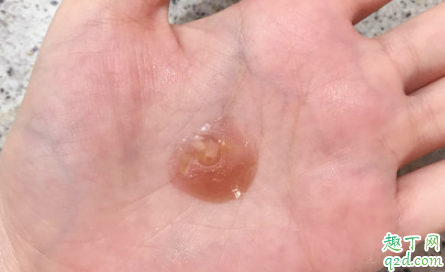 天露芬沙棘双效精华孕妇可以用吗 天露芬沙棘双效精华适合油皮吗