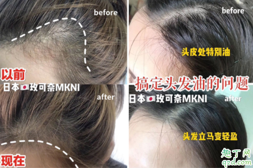 玫可奈洗发膏怎么样 MKNI玫可奈洗发膏使用评测
