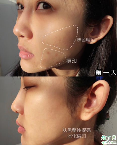 雅诗兰黛肌光精华和小棕瓶哪个好 雅诗兰黛肌光小棕瓶线雕精华的区别