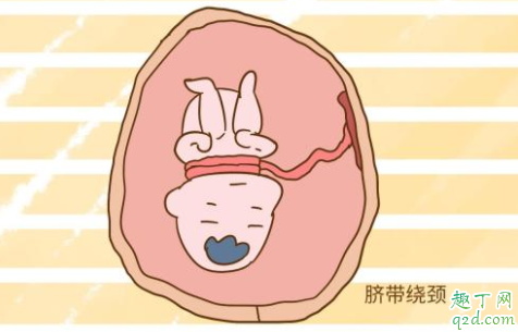 新生儿脐带有点出血怎么回事 脐带脱落几天了还出血怎么办