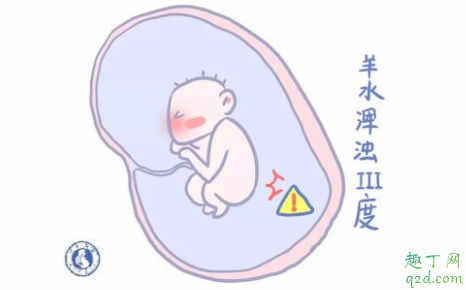 羊水偏多怎么改善 羊水偏多一定是畸形吗