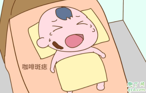 怀孕肚子受到撞击会留下胎记吗 宝宝有胎记怀孕时能检查出来吗?