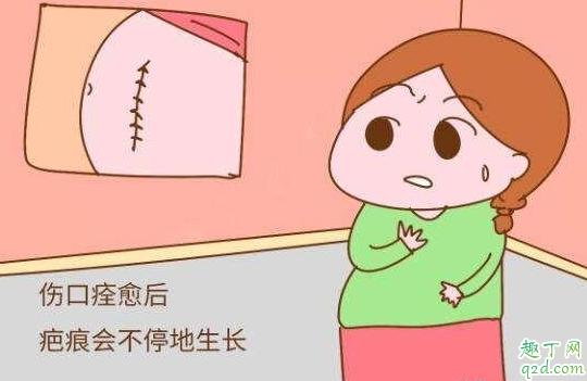 春季剖腹产坐月子如何护理 春季剖腹产坐月子要注意什么