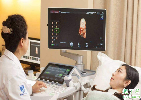 四维怎么让宝宝动的欢 查四维孩子趴着的有什么办法