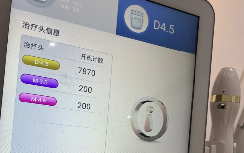 超声炮10天了咬肌大正常吗-超声炮10天效果图