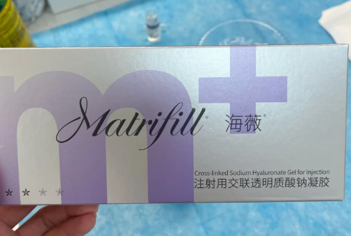 海薇玻尿酸适合打哪里-海薇玻尿酸能维持多久